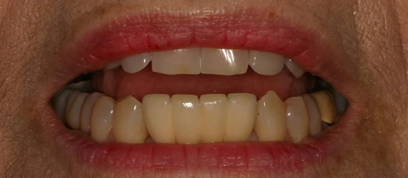 Before