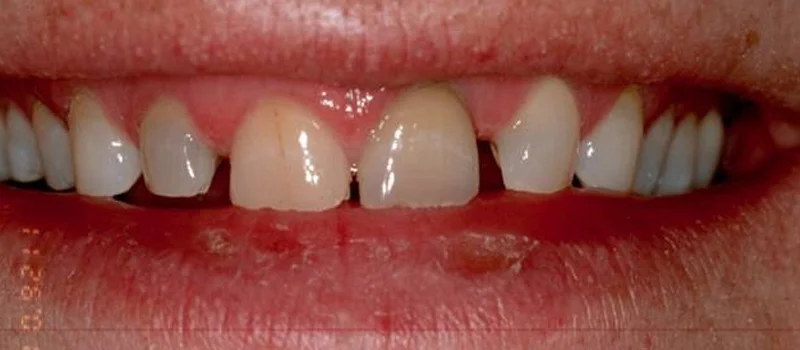 Before