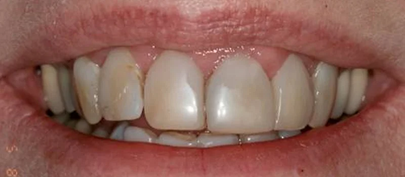 Before