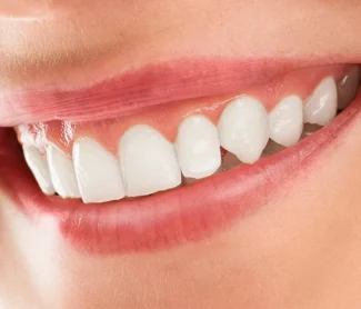 Teeth Whitening