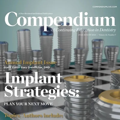 Immediate Loading: Importance of Osteotomy Preparation