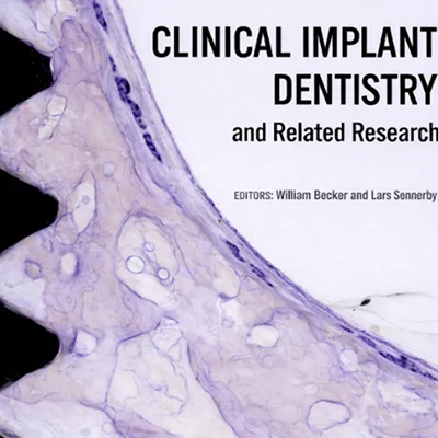 Multistepped Drill Design for Single-Stage Implant Site Preparation: Experimental Study in Type 2 Bone 